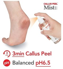Callus Peel Mist Kit (1.69 oz.+Cream Kit) 301